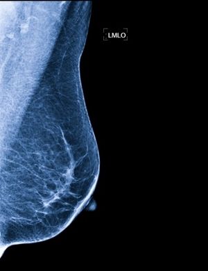 Poradnia onkologiczna